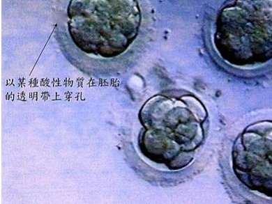 杭州有三代试管婴儿医院吗？哪些医院技术好？